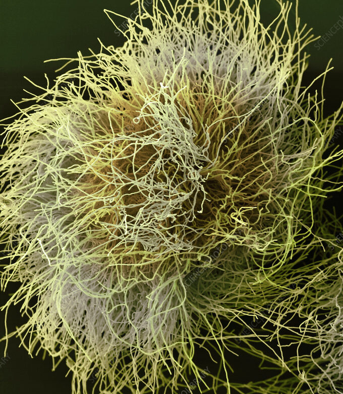 Kolonie Trichophyton rubrum v elektronovém mikroskopu. Převzato z: https://www.sciencephoto.com/media/1271425/view
